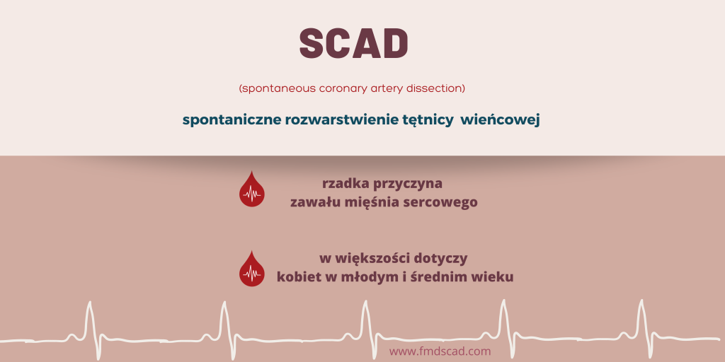 Czym jest SCAD 2